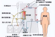 健康科普 血液透析患者的生命线--血液透析通路