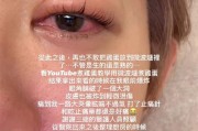 突然爆炸！女星自曝：眼球险些炸破痛到眩晕！很多人还在尝试