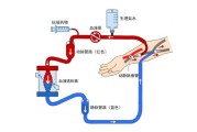 威高血净登陆A股血液净化赛道迎来哪些新变化？
