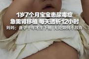 痛心！女子备孕10年生下宝宝患尿毒症急需肾移植每天透析12小时；妈妈：无论如何不放弃