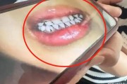 甘肃天水幼儿园铅中毒应该不是故意投毒而是不知添加剂内含铅